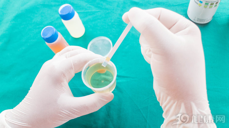 尿蛋白提示neg,尿蛋白会误诊吗