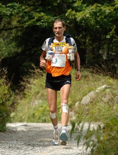 跑步跑的掉发,跑步掉发吗