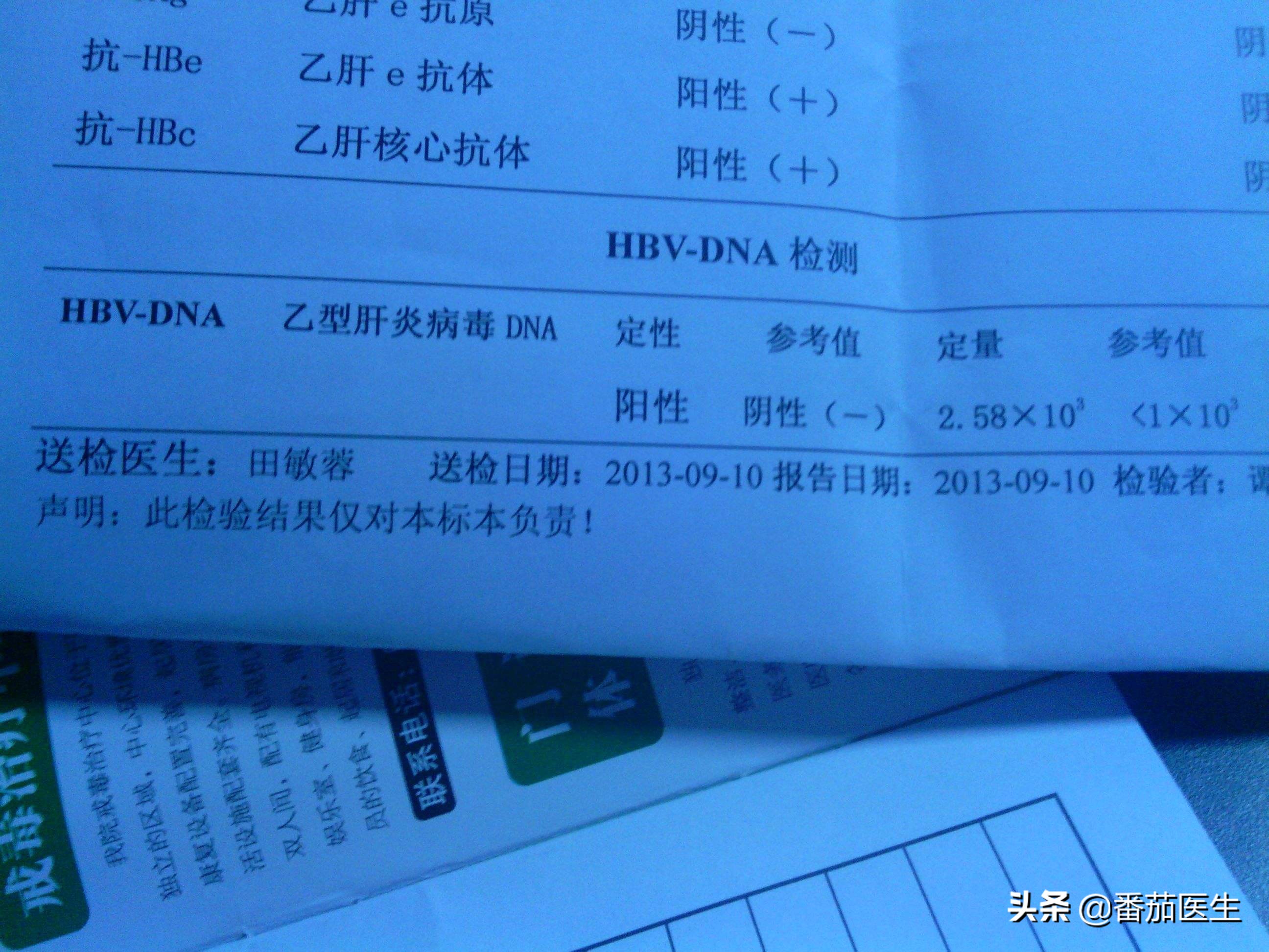 乙肝患者如何判断乙肝病情轻重,乙肝病毒10的几次方代表病情轻重