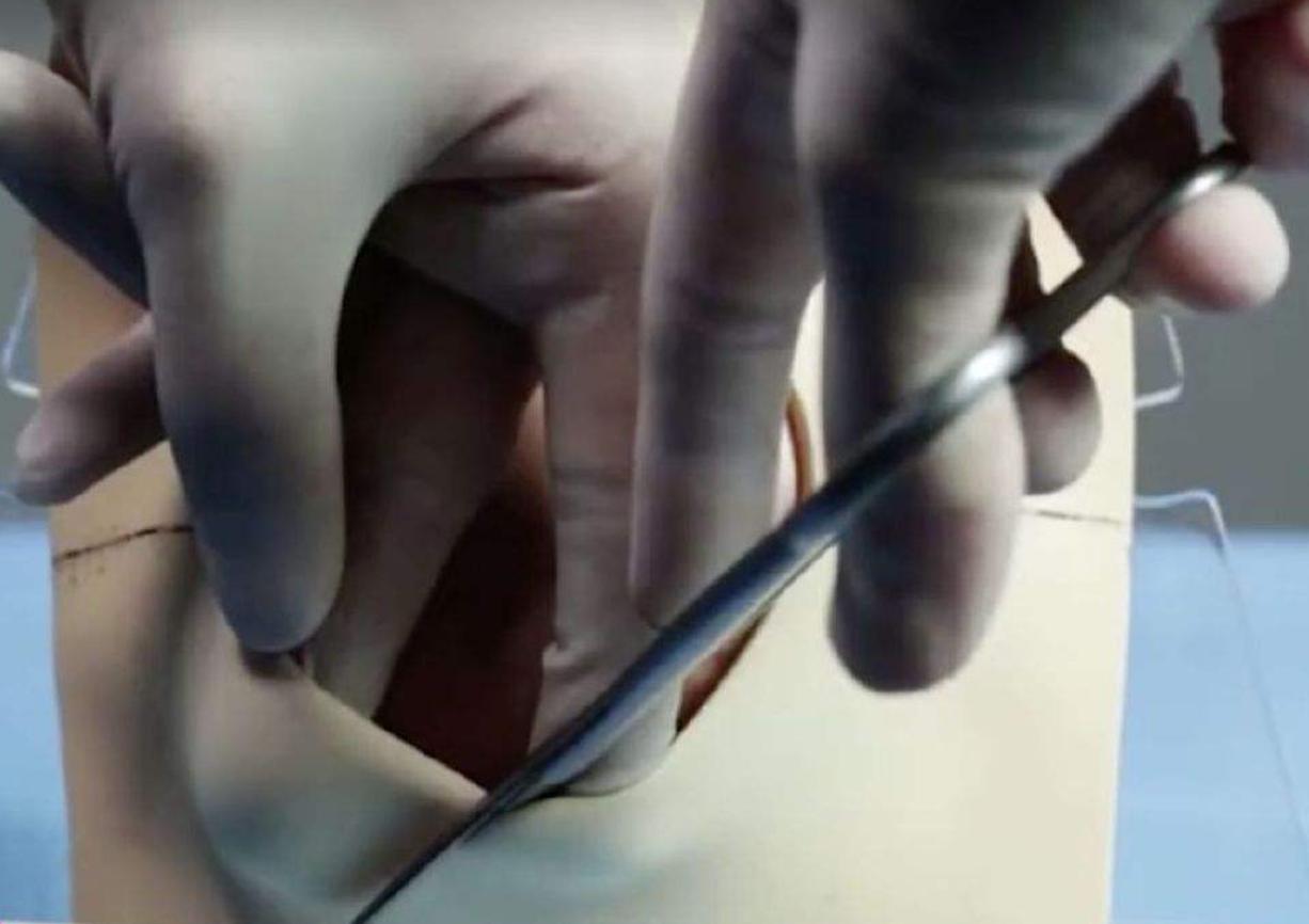 顺产很尴尬怎么办,顺产尴尬吗