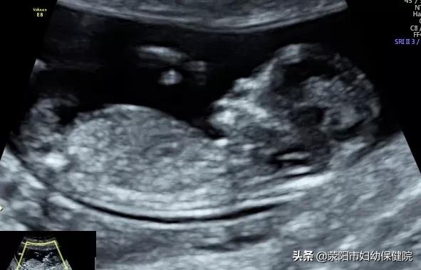 新冠后备孕检查,孕妇新冠诊疗手册