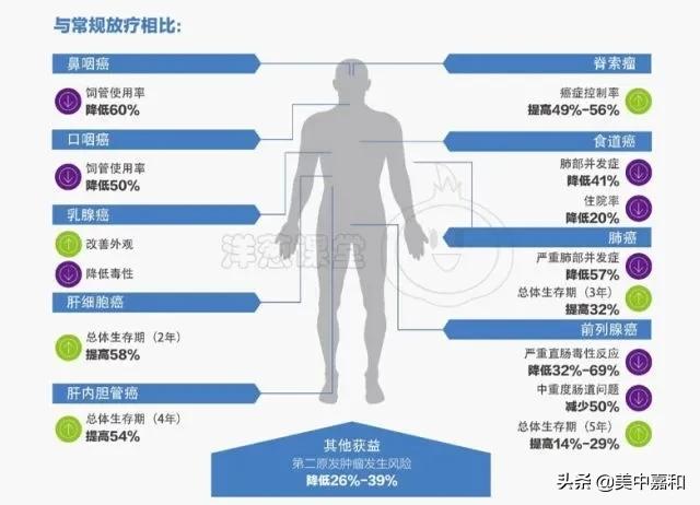 质子放疗治疗肿瘤,肿瘤放射治疗用什么射线