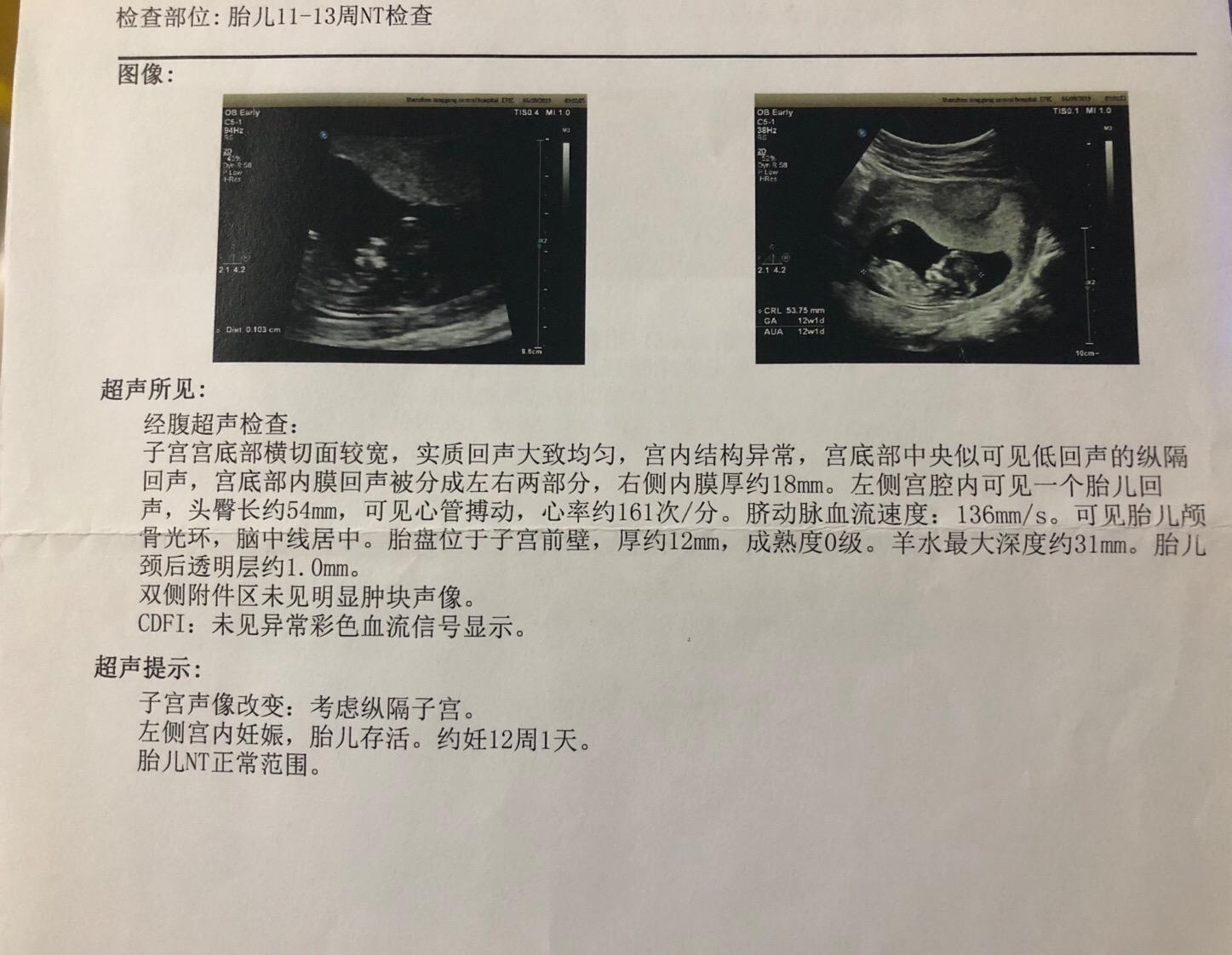 妇产科医生对孕妇的忠告,妇产科孕早期健康指导