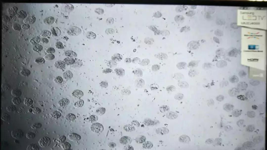 暴发“鱼瘟”救治时不可忽视寄生虫的危害---低温时节鱼类斜管虫病的症状及防治