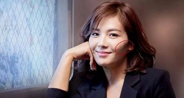 有效去除高颧骨,怎么样才能拯救高颧骨还外扩的脸