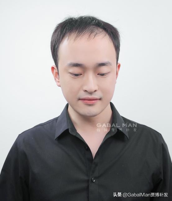 秃头的最大好处是什么,秃头的好处和坏处