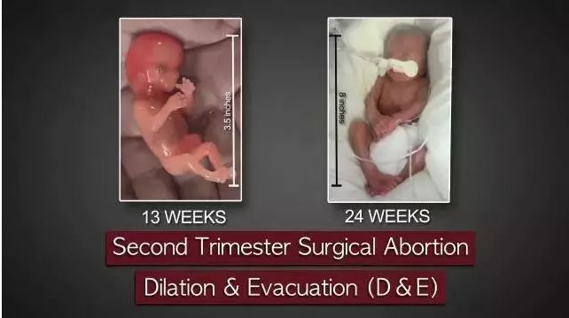 25岁的女生有几次打胎,女子堕胎6次连医生都惊讶了