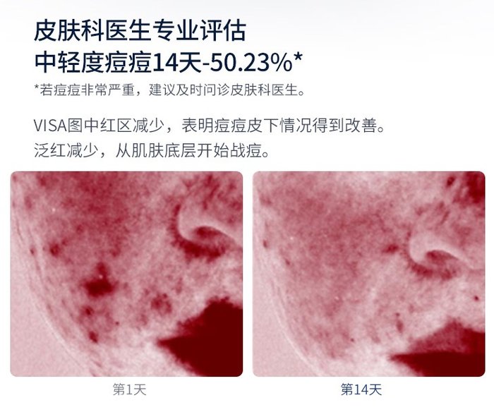 送男友适合油敏痘的护肤品,女生最爱的礼物排行榜