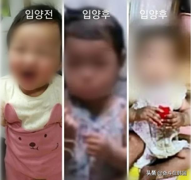 男童被虐待肝破裂,韩国小孩被家暴内脏破裂