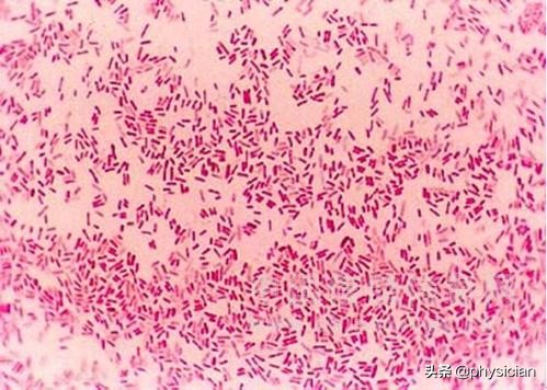 腹痛拉肚子是怎么回事要吃什么药,拉肚子拉绿色的是什么病吃什么药