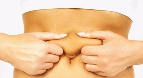 肥胖纹妊娠纹还有什么纹,肥胖纹或者生长纹怎么消除