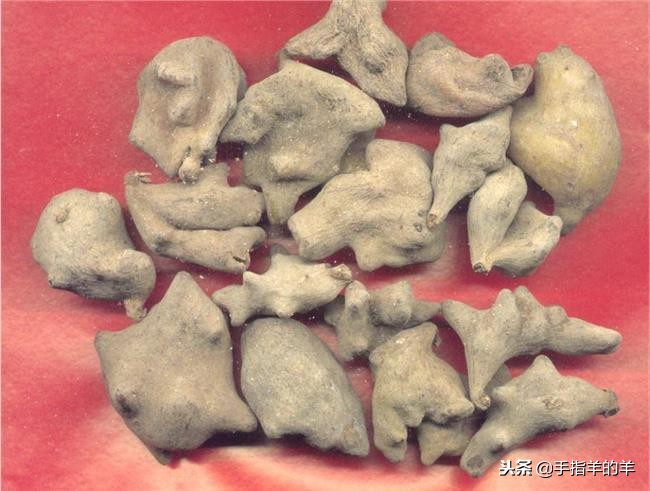 牙疼的原因和止疼妙招,牙疼不是病疼来要人命该怎么办