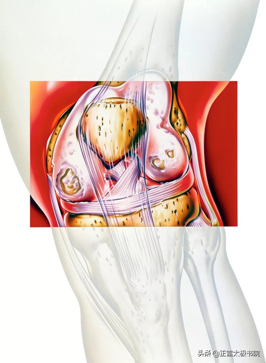 练拳的十大忌讳,练拳伤到骨头怎么办