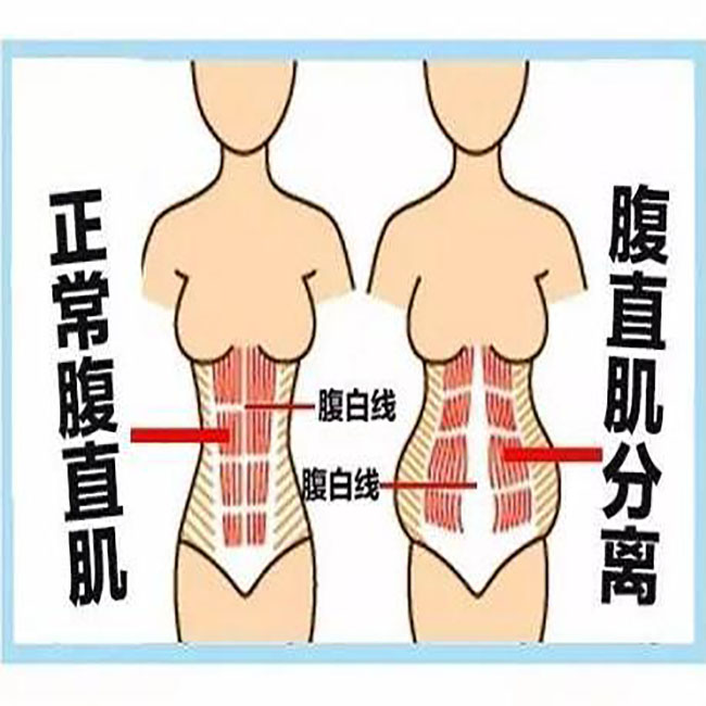 怀孕后屁股越来越大怎么回事,刚怀孕感觉屁股大了怎么回事