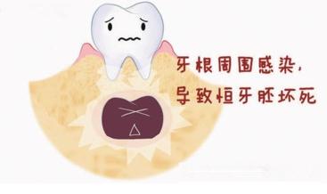 父母必看孩子教育,父母换牙需要关注什么