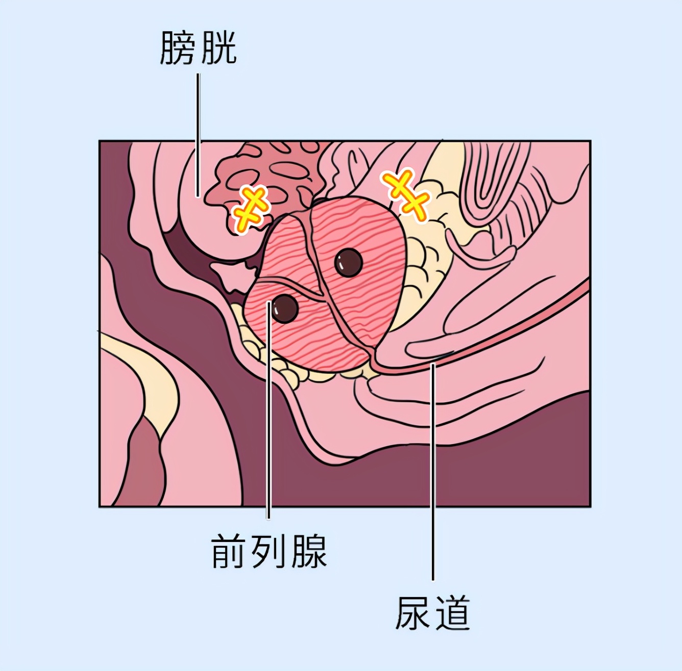 你们的前列腺在喊“救命”，因为你压着它了