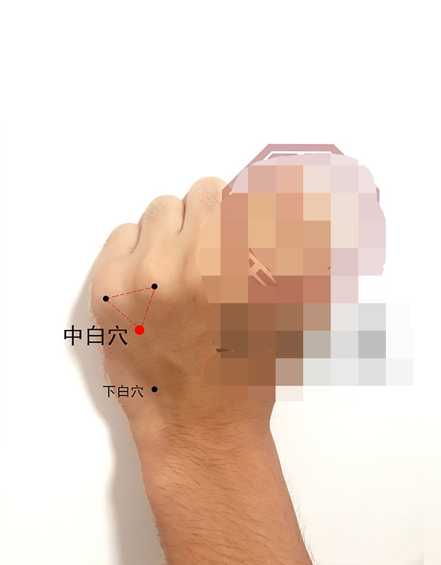 中医针灸耳朵疾病配穴处方,针灸耳朵可以治疗哪些病