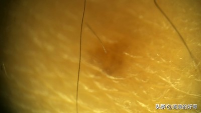 oppofindx3pro显微镜拍螨虫,oppofindx3显微镜可以看螨虫吗