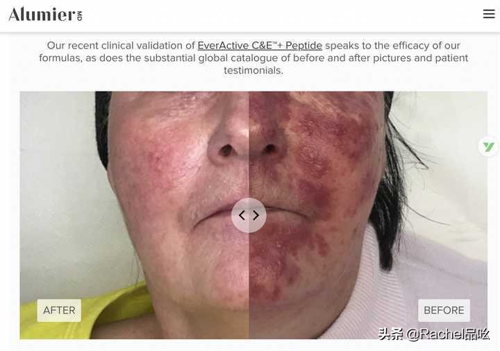 30岁以后用的平价抗老精华,30岁最值得买的抗老精华