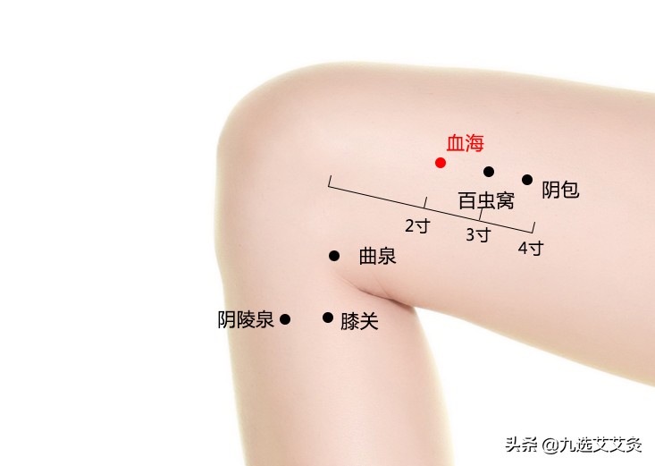 湿疹按哪个穴位就管用,湿疹的最佳穴位在哪里