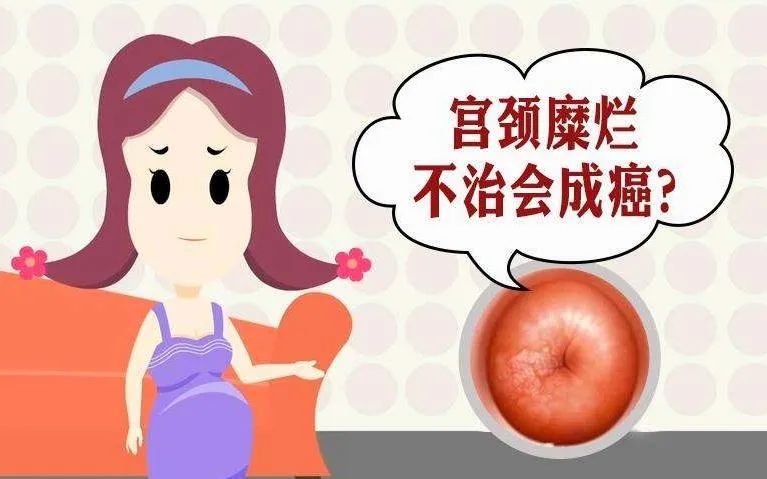宫颈疾病症状,宫颈疾病和丈夫有关系吗