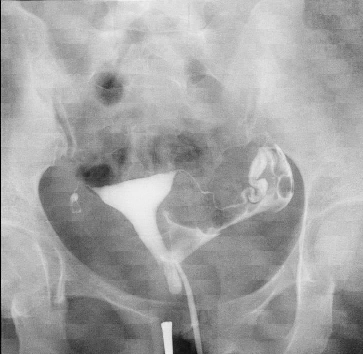 农村贫困家庭不孕治疗指南，教你用最省钱的方法快速好孕