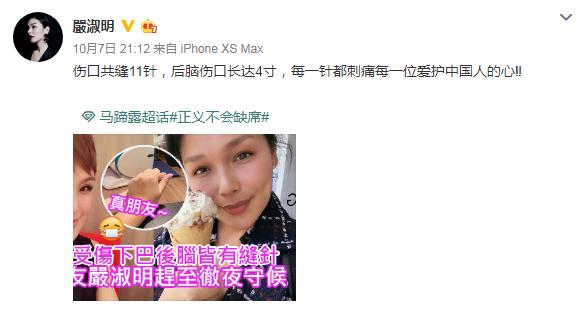 香港年轻丑角女艺人马蹄露,丑角马蹄露个人资料