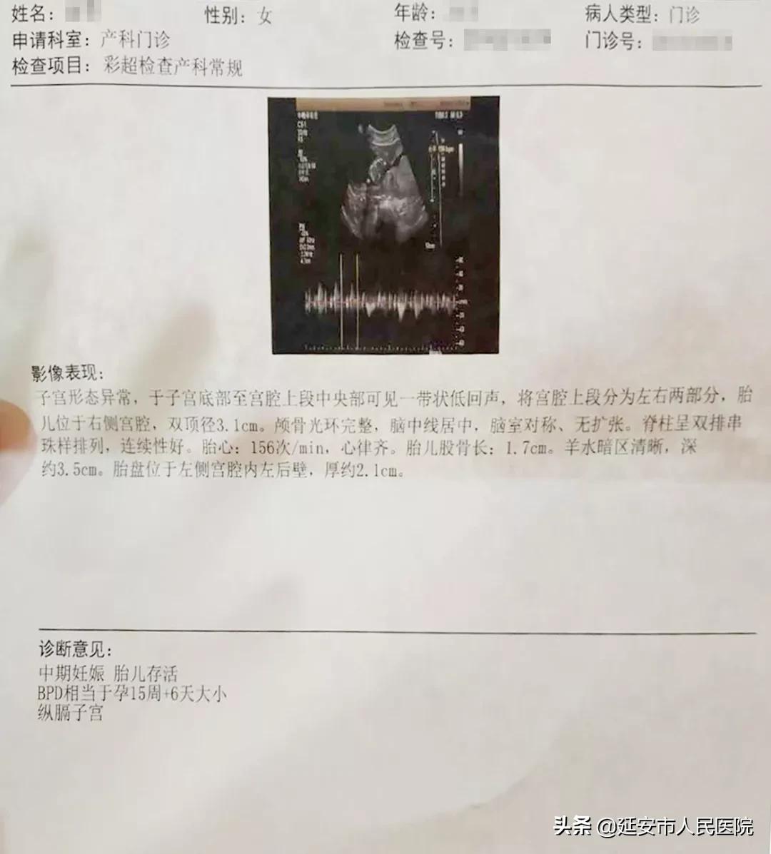 延安市人民医院中医科杨志琴主任中西医结合巧治不孕不育症