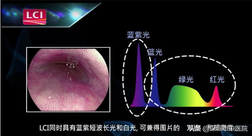 这个神器让肠道“违建”无处遁形！全国首套在深圳启用