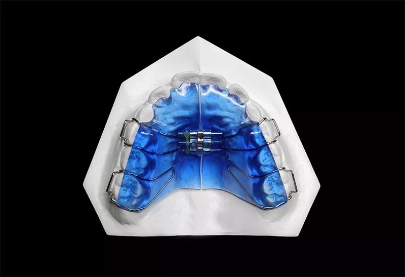 正畸主治学习视频,正畸钟摆效应名词解释