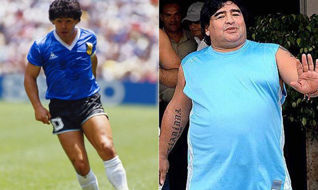 马拉多纳是不是整容了,马拉多纳整容后照片