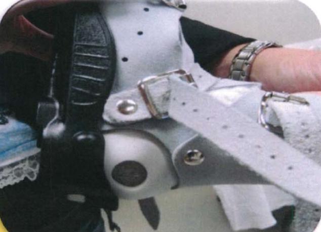 马蹄内翻足支具需要穿多久,马蹄内翻足穿鞋了怎么按摩