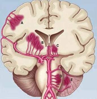 怎样会引起颅压高,颅压增高是怎么引起的