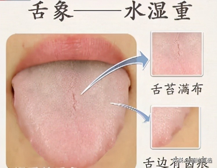 珍贵的舌诊图谱，看舌头知健康，人手一份！你也能快速识别疾病