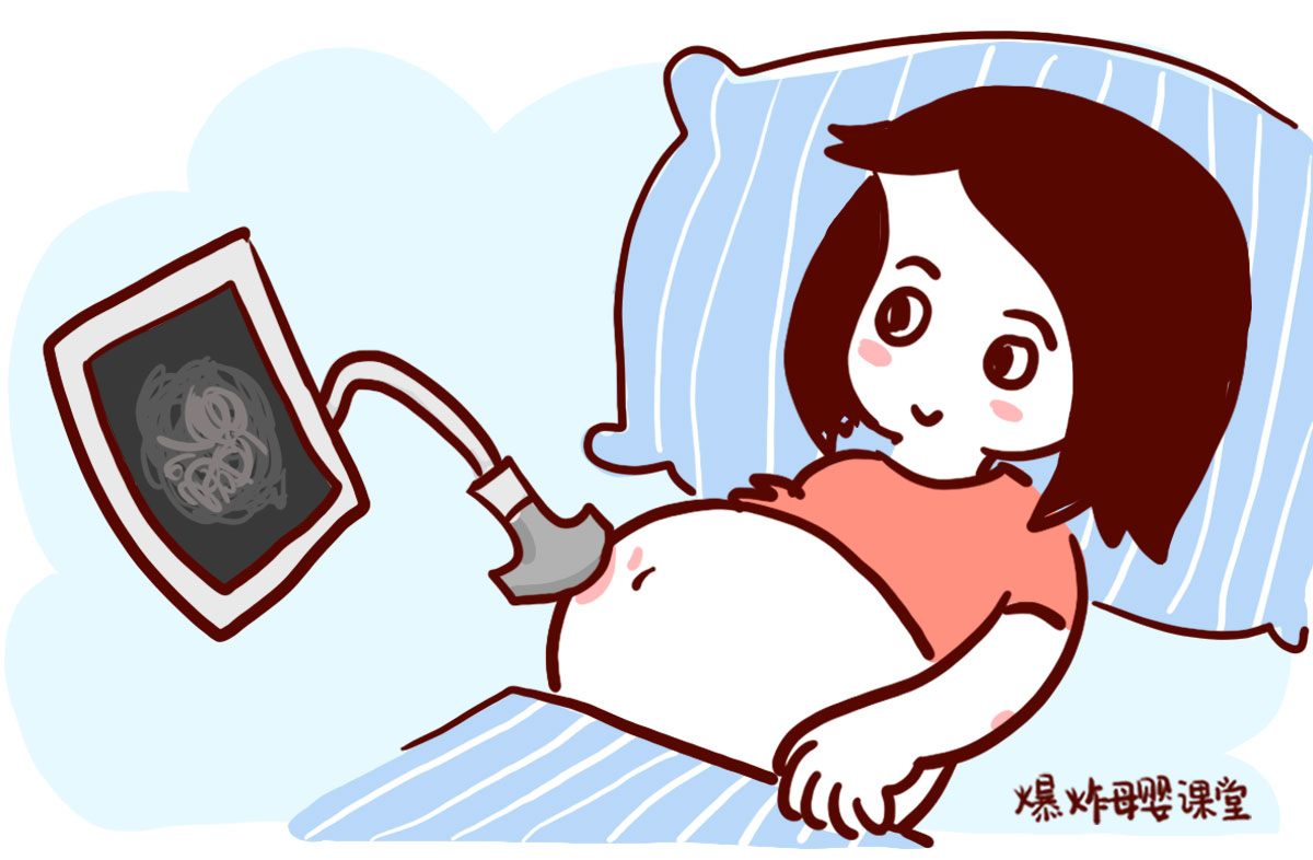 怎么判断产妇是不是要生了,生没生过孩子医生真能看出来吗