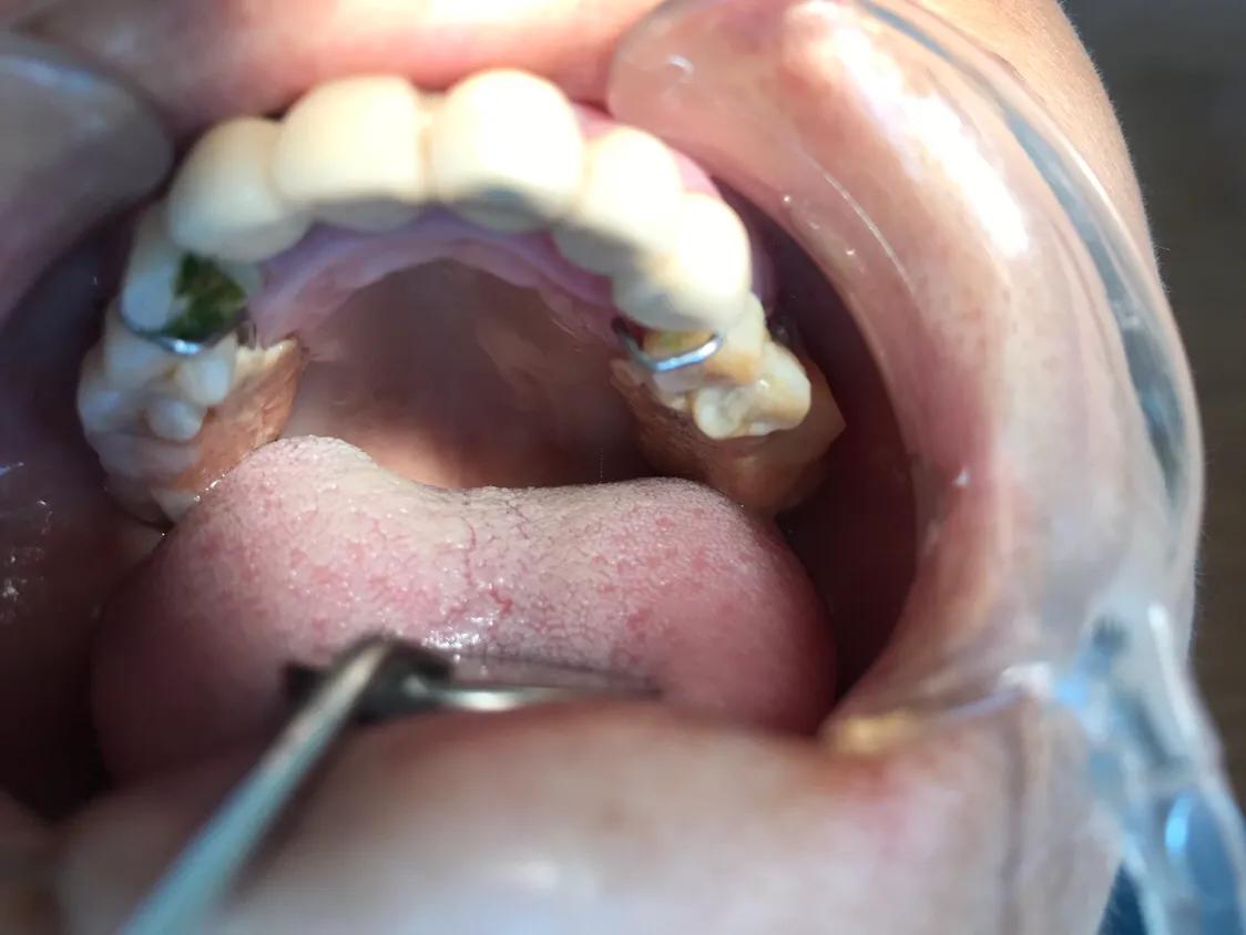 口腔垃圾怎么处理,口腔护理中的垃圾怎么分类处理