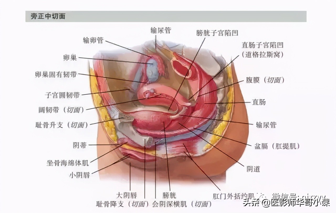 盆腔积液ct解剖图谱,盆腔解剖图谱手绘步骤
