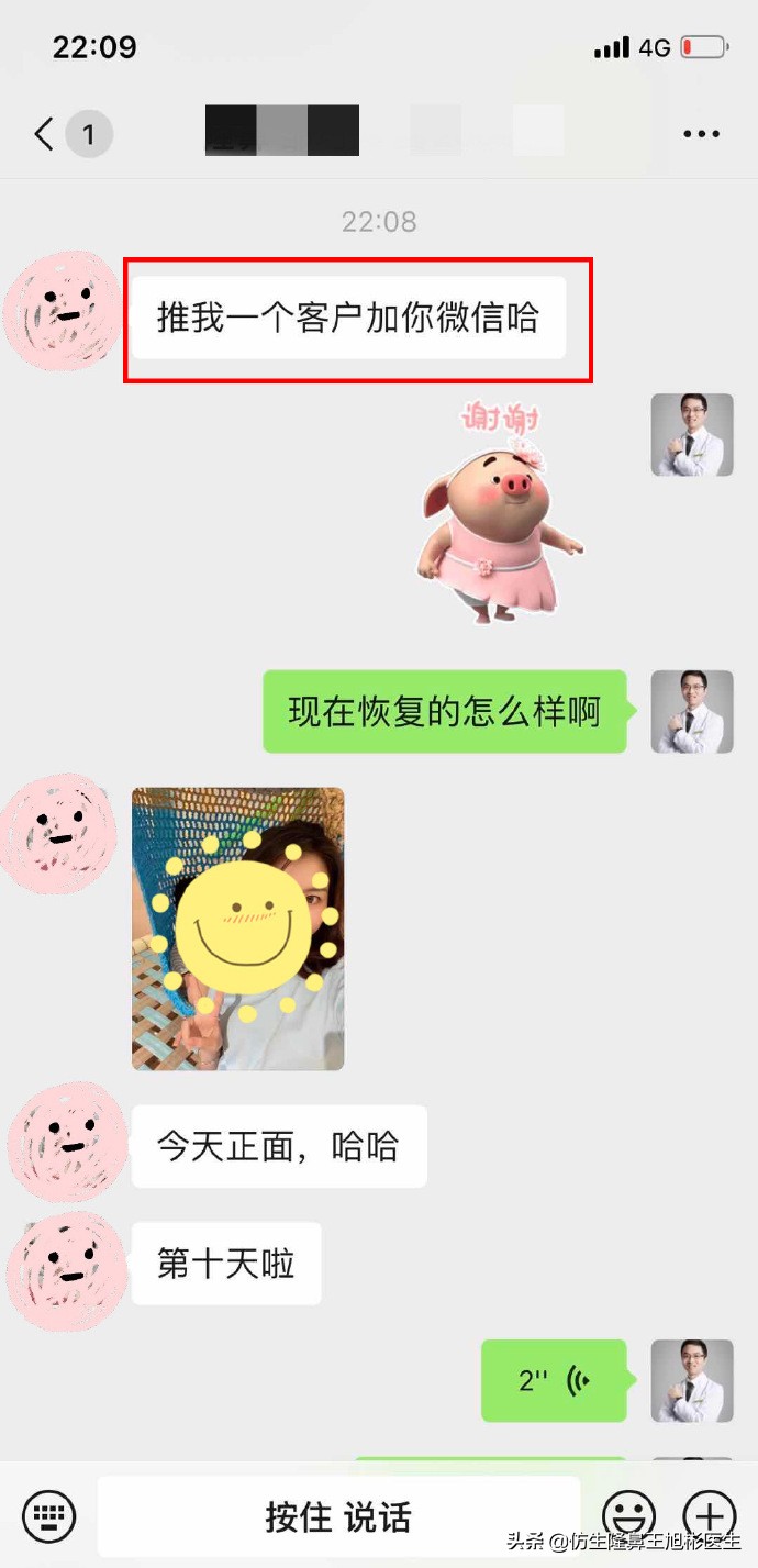 鼻头肥大矫正加鼻翼缩窄案例,鼻头缩小术后