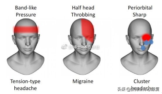 头痛康复锻炼方法,运动导致的头痛怎么缓解