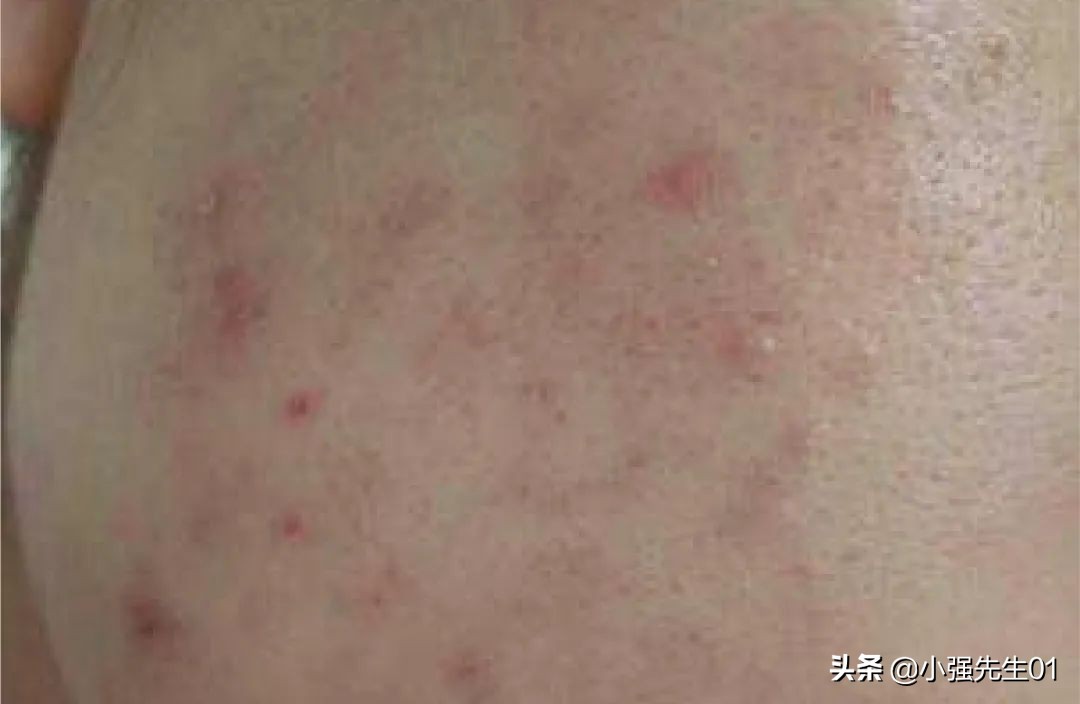看完这些廉价面膜你还敢买吗,便宜又烂脸的面膜有哪些