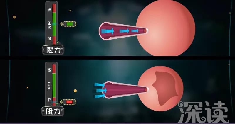 肺气肿一吸烟就咳嗽怎么回事,吸烟后痰多支气管炎