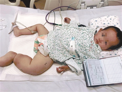 2岁女童患癌症轻松筹,两岁女童筹款800万