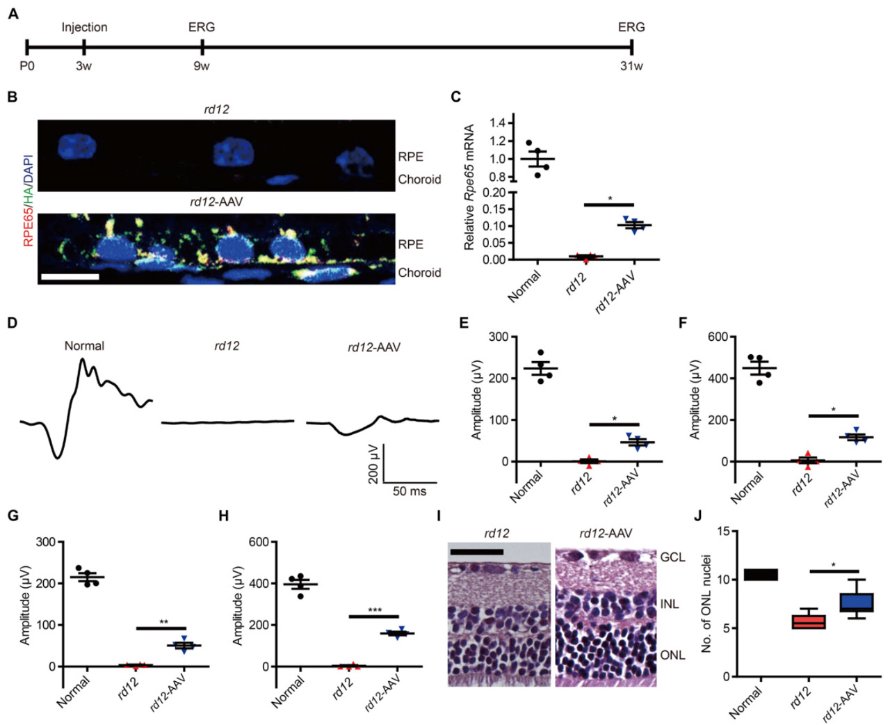 基因治疗眼睛失明中国最新进展,基因编辑治疗眼科疾病2019