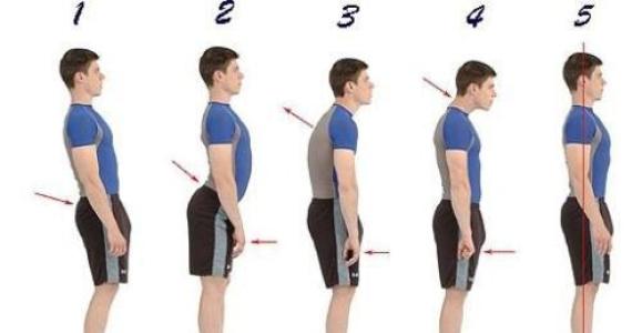 驼背怎么矫正最快的方法,驼背怎么快速矫正
