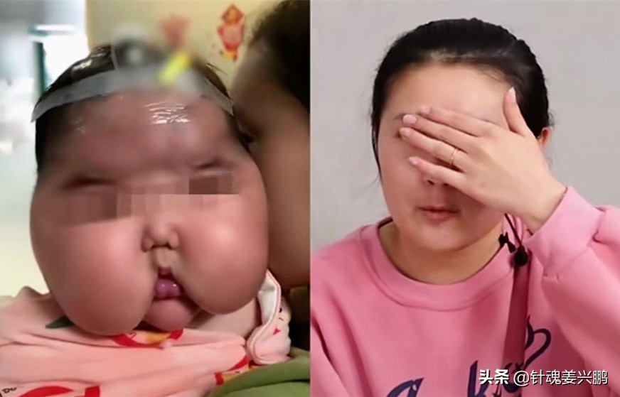 三个月宝宝身体长汗毛,婴儿霜导致婴儿长胖