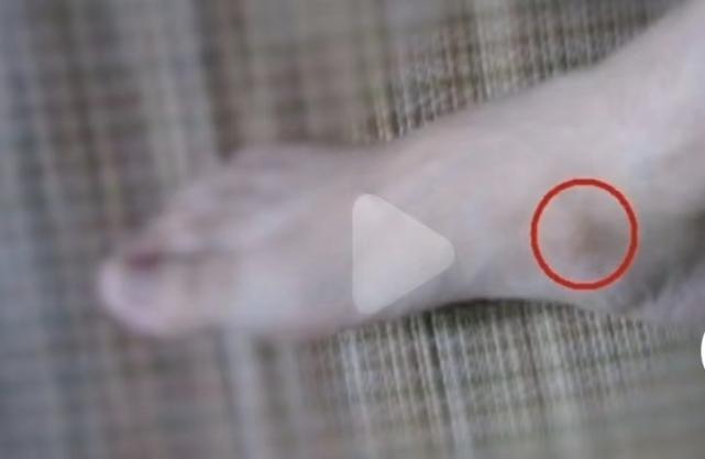 孩子走路“内八”or“外八”，可能和这3个小习惯有关