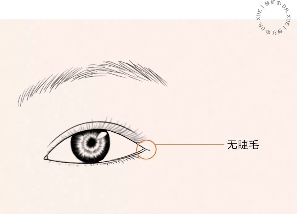 什么样的眼睛适合开外眼角,要不要做内外眼角