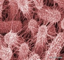 生活中有哪些常见凶险的致病菌,防控病原菌受到污染的措施主要有