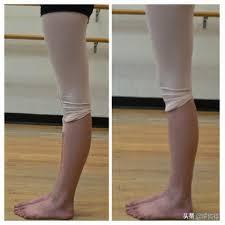 什么是膝盖过度伸展（膝盖超伸）？在瑜伽中怎么改善和正位？