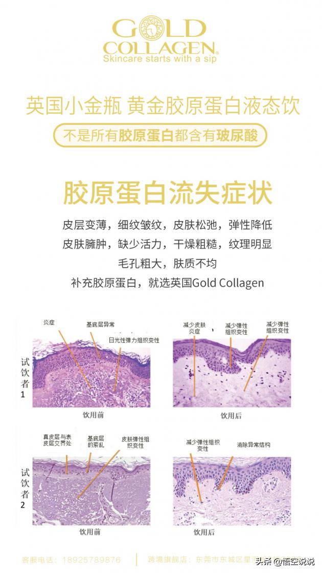 减龄黑科技“GoldCollagen”,让你轻松Get少女颜